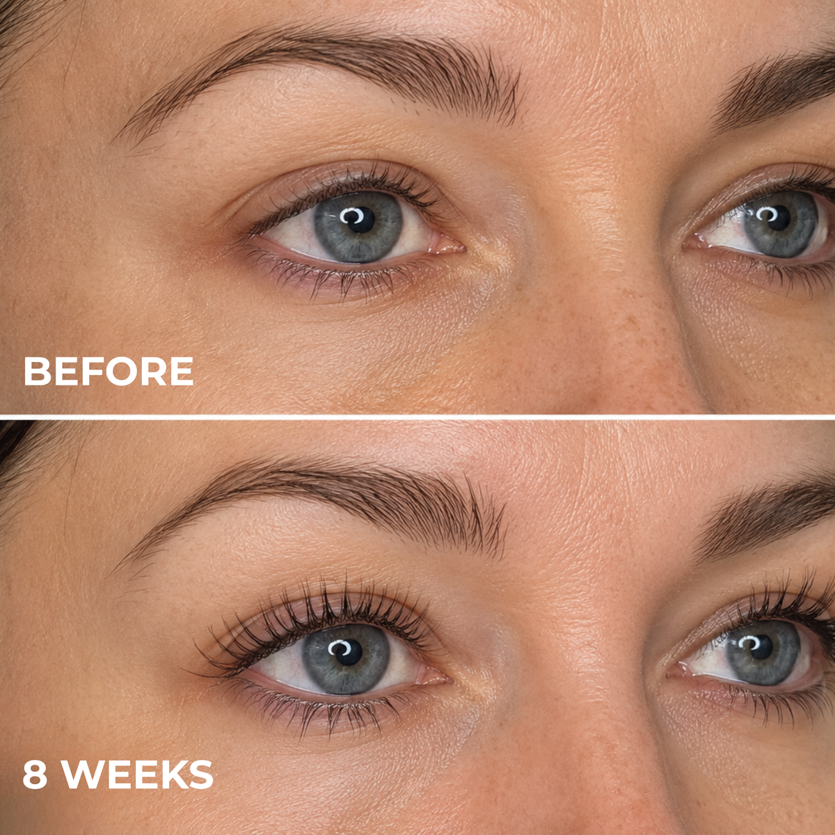 Before and 8-week comparison of lashes when using Genology peptide eyelash serum